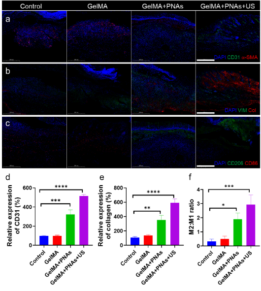 333���� - ��̬�ȵ������Ż�